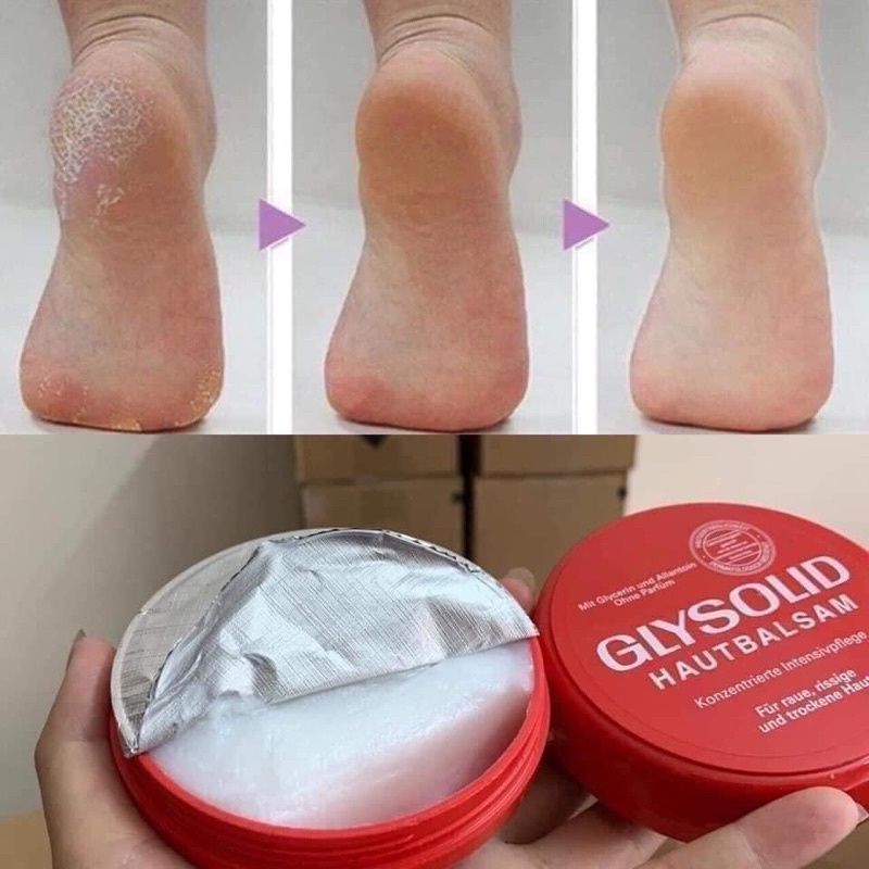 کرم مرطوب کننده کاسه فلزی  GLYSOLIبسیار با کیفیت